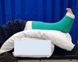 Foot in cast raised