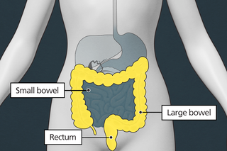 Colonoscopy