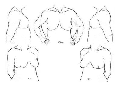 Breast photography drawing