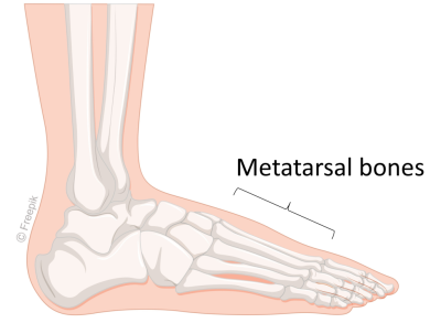 Metatarsal bones