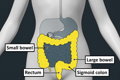 Sigmoid colon pic.png