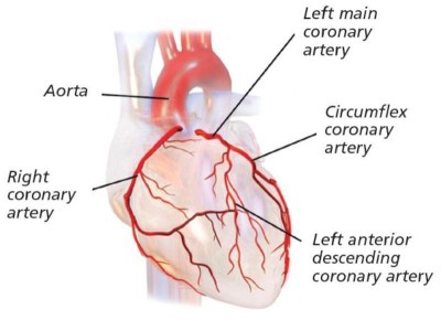 coronary arteries image