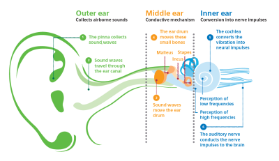 Audiology-leaflet-diagram.png