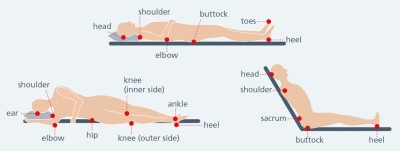 Pressure sores diagram